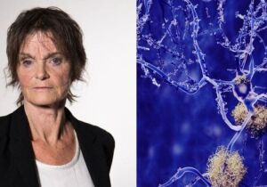 Cientista está a um passo da cura da esclerose múltipla